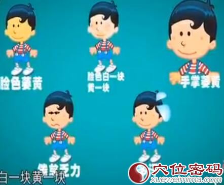 小儿内热的表现症状图