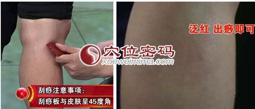 刮痧刺激阳陵泉、胆囊穴的方法