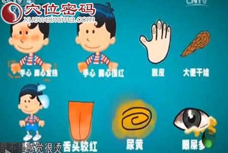 小孩子内热上火的症状表现图
