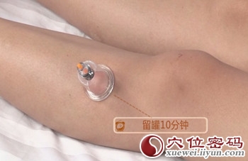 拔罐治疗妊娠呕吐的穴位：<a href='http://www.liuyanbao.net/rentixueweichaxun/689.html' target='_blank'><u>足三里</u></a>穴的拔罐方法