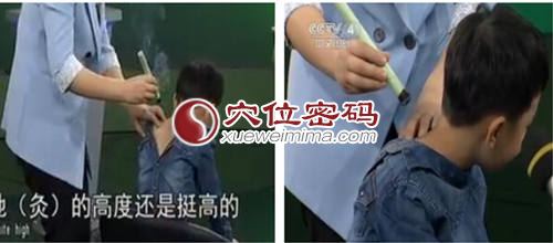 艾灸身柱穴治疗小孩子咳嗽